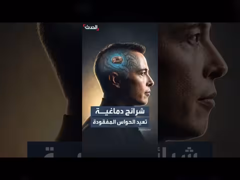 نيورالينك وتقنيات الشرائح الدماغية