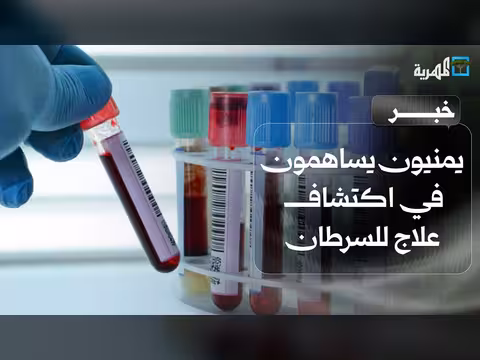 باحثون يمنيون يشاركون في اكتشاف مركبات لعلاج سرطان خطير