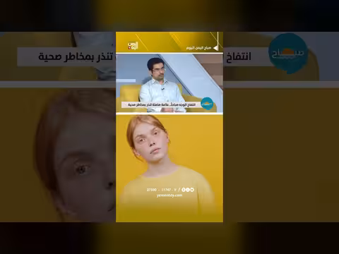 انتفاخ الوجه الصباحي قد يكون إنذاراً