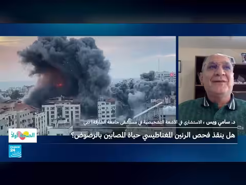 دور فحص الرنين المغناطيسي في إنقاذ مرضى الرضوض الطارئة