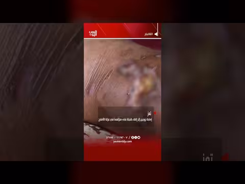 إصابة زوجين في عزلة الأصابح