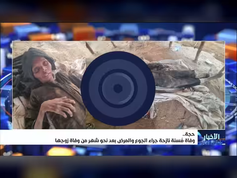 وفاة نازحة يمنية جراء الجوع والمرض