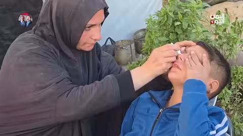 غزة بعد الحرب: معاناة مستمرة وجراح لا تلتئم