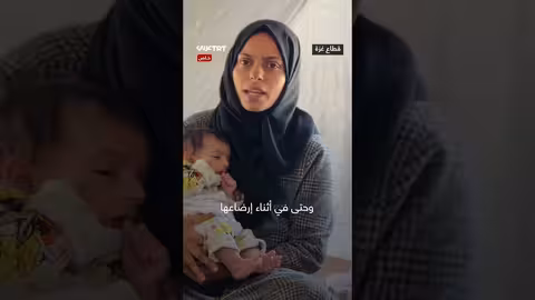 طفلة فلسطينية تعاني أكياساً دموية بسبب استنشاق غازات سامة خلال قصف