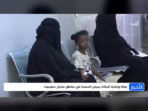 وفاة وإصابة المئات بمرض الحصبة في حضرموت