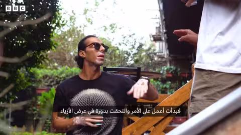 كيف أصبح البهاق عنصر تميز لمحمود حسن في عروض الأزياء