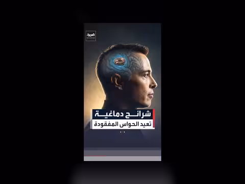 نيورالينك وتقنيات الشرائح الدماغية