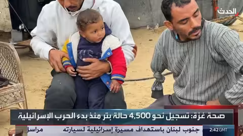 مخبز غزة يوحّد عائلة فقدت أطرافها بالحرب