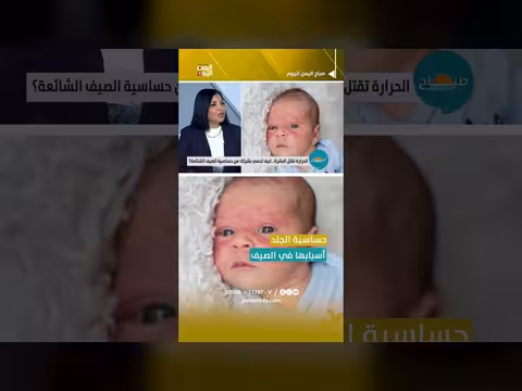 كيفية حماية بشرتك من حساسية الصيف