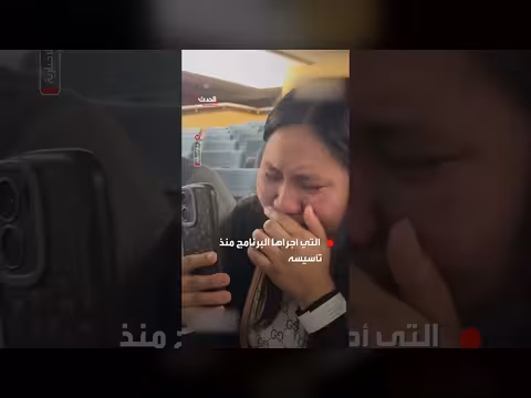 نجاح عملية فصل توأم ملتصق بالرياض