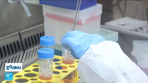 سويسرا: الحوسبة الحيوية بخلايا دماغية بشرية لمستقبل التكنولوجيا