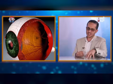 نصائح الصيام والعناية بالعيون مع الدكتور علاء المجاهد