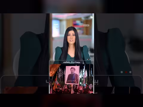 إصابات خطيرة وتشوهات بوجه المرشد الإيراني الجديد