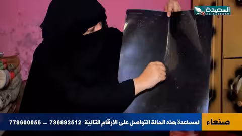 ورم يلتف حول الشريان… منى الريمي بين الحياة والموت!