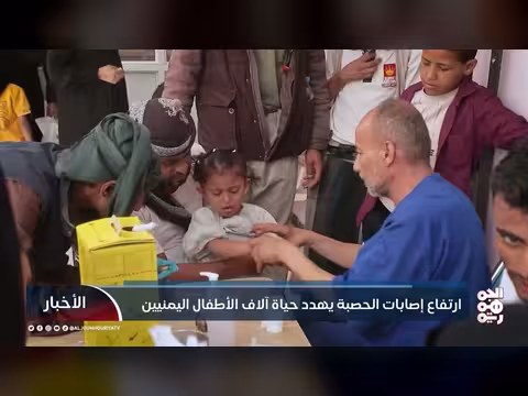 ارتفاع إصابات الحصبة في اليمن