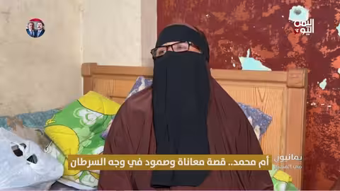 أم محمد: معركة يمنية مع السرطان والتحديات الصحية