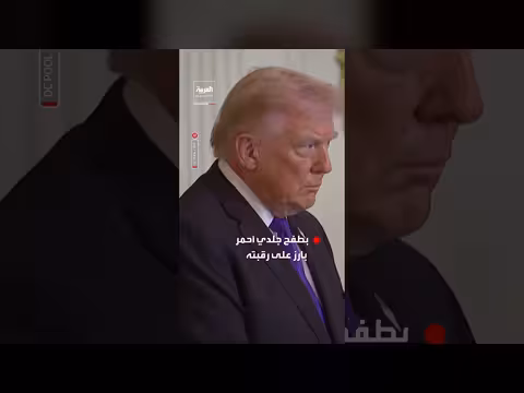 ترمب يظهر بطفح جلدي أحمر في فعالية بالبيت الأبيض