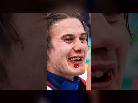 إصابة أسنان اللاعب الأمريكي هيوز لا تمنعه من قيادة بلاده للفوز بالذهب