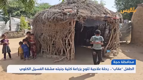 رحلة علاجية لطفل يمني تنتهي بزراعة كلية ناجحة