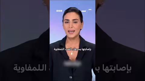 المذيعة اللبنانية ربى حبشي تعلن إصابتها بالسرطان