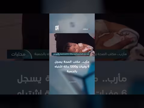 مأرب: 6 وفيات و1200 حالة اشتباه بالحصبة