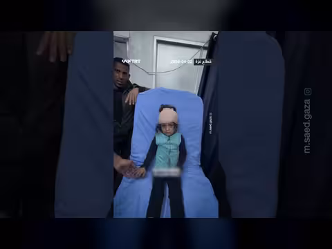 طفلة فلسطينية مصابة بجروح في رأسها