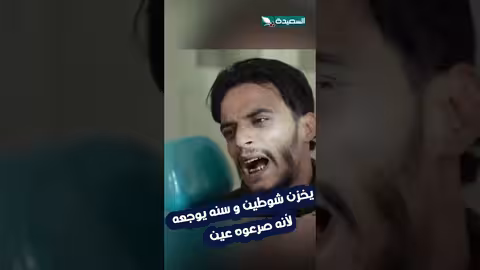 طبيب أسنان ينتقد إهمال مريض في نظافة أسنانه
