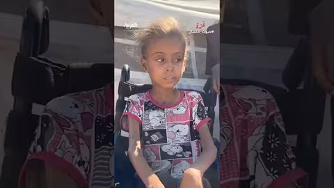 أم يمنية تناشد لعلاج ابنتها ووقف الحرب