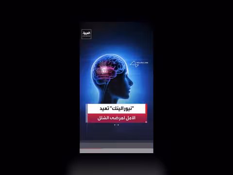 شريحة نيورالينك تعيد سيدة مصابة بالشلل إلى حياتها