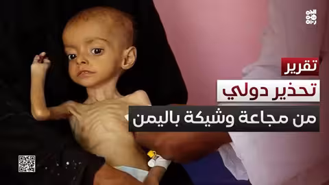 اليمن: 47 منظمة إغاثية تحذر من مجاعة كارثية وشيكة