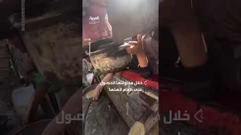 طفلة فلسطينية تصاب بحروق أثناء محاولة إحضار الطعام لأهلها