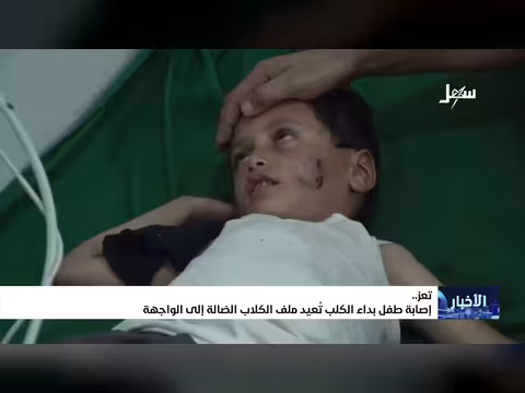 إصابة طفل بداء الكلب في تعز