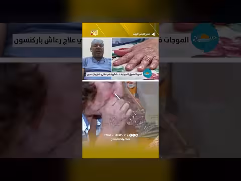 ثورة الموجات فوق الصوتية في علاج رعاش باركنسون