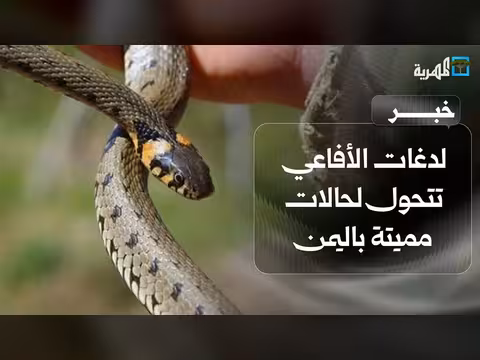 أطباء بلا حدود تحذر من لدغات الأفاعي المميتة