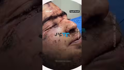 فلسطيني يروي تفاصيل اختطافه ومحاولة قتله من قبل مستوطنين