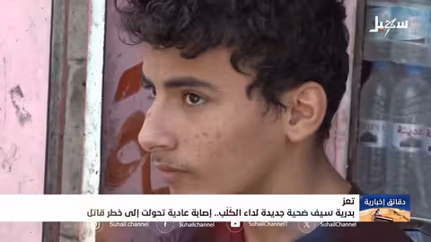 بدرية سيف ضحية لداء الكلب في تعز