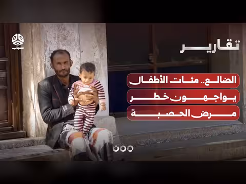 مئات الأطفال في الضالع يواجهون خطر مرض الحصبة