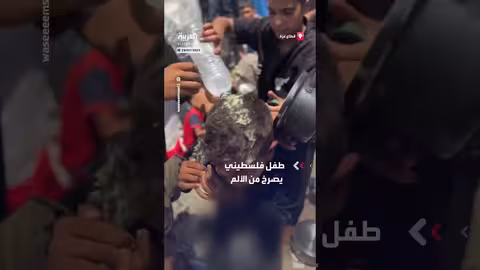 طفل فلسطيني يتعرض لحروق إثر سقوط قدر ساخن عليه