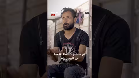 معاناة أم يمنية بسبب نقص التغذية لطفلها