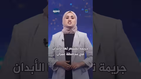 عمران: مواطن يتهشم جمجمة طفل بدعوى طقوس سحرية