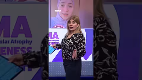 أم مصرية تواجه تحديات الضمور العضلي الشوكي لطفلها