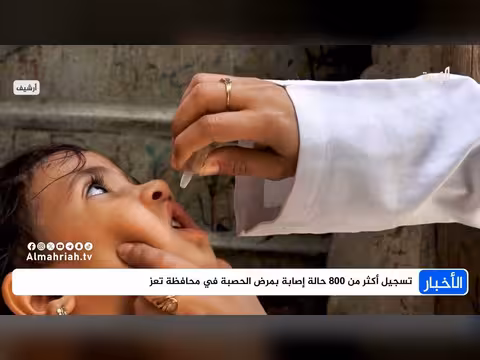 تسجيل 800 إصابة بحصبة في تعز