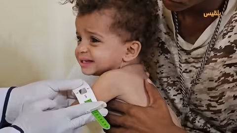 اليمن: تهريب أسلحة حوثية، تصعيد انتقالي، وأزمة أطباء وسوء تغذية