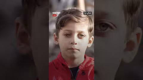 طفل غزي يفقد عينه جراء قصف إسرائيلي