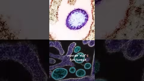 منظمة الصحة العالمية: احتمالية انتشار نيباه خارج الهند منخفضة