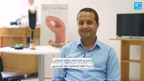 شركة كيربينكس التونسية تطور أطرافًا صناعية بأسعار معقولة