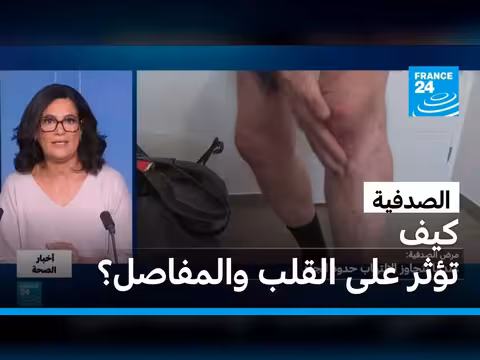 الصدفية تأثيرها على القلب والمفاصل
