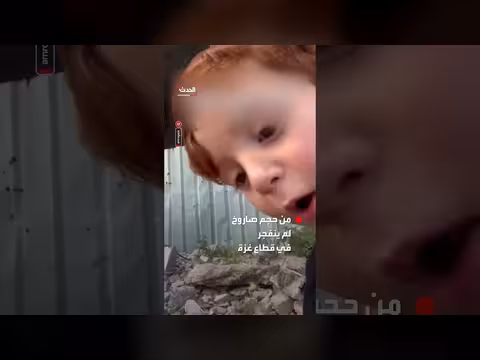 طفل فلسطيني مصدوم من صاروخ لم ينفجر في غزة