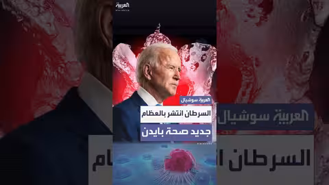 بايدن يخضع لعلاج إشعاعي بعد تشخيص إصابته بالسرطان