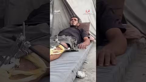 نازح يروي معاناته وفقدانه لأسرته والجوع في اليمن